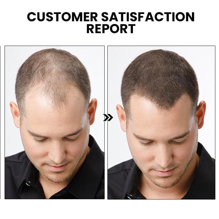 Thailand hair growth spray